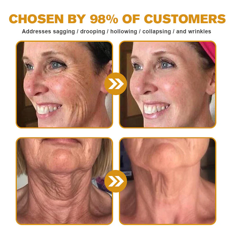 👨⚕️ Botox Bee Venom Wrinkle Removal Cream- LAST DAY 70% OFF✅