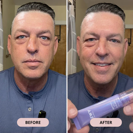 Instant Lift Eye Gel