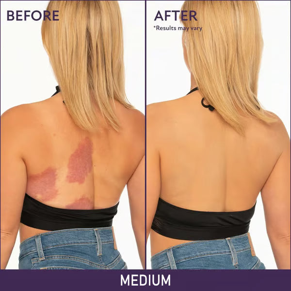 🎁Last Day Sale 49% OFF🔥Soft Matte Cream Concealer