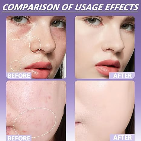 🎁Last Day Sale 49% OFF🔥Soft Matte Cream Concealer