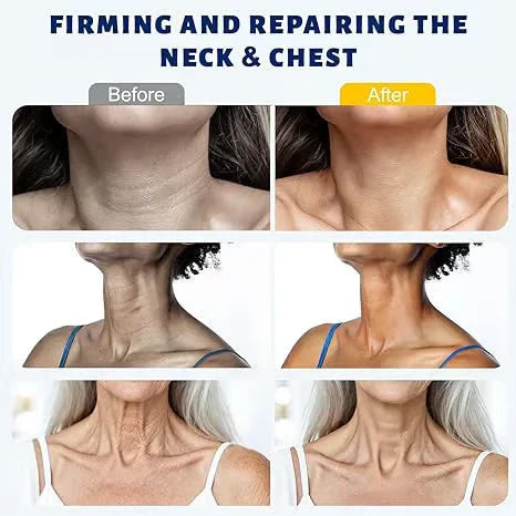 Roller Massage Neck Cream 🧴 Collagen & Hyaluronic Acid | Firms Neck, Reduces Wrinkles & Double Chin