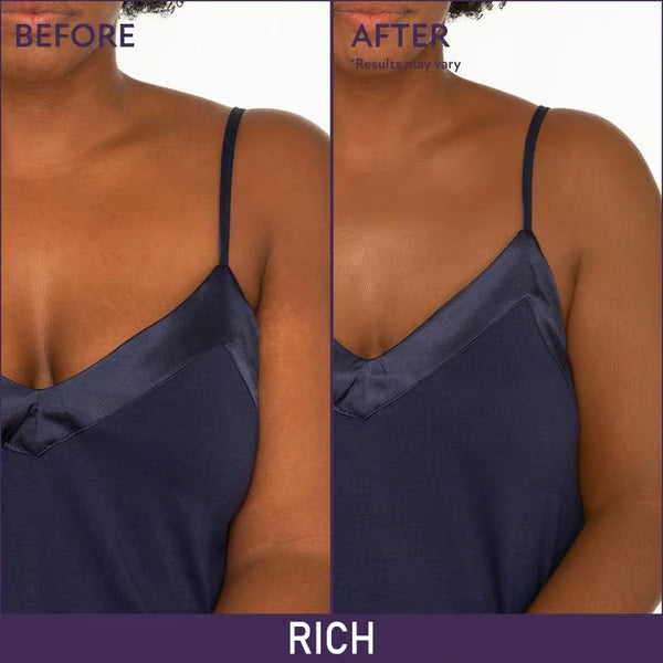 🎁Last Day Sale 49% OFF🔥Soft Matte Cream Concealer