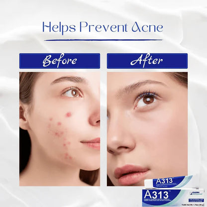 ✨ Get Clear, Radiant Skin Fast - 50% OFF- ✨ Ultimate A313 + HA Skincare Duo - For All Ages