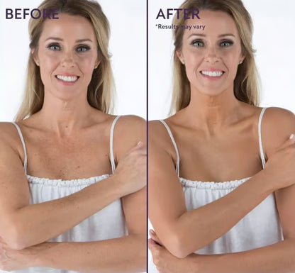 🎁Last Day Sale 49% OFF🔥Soft Matte Cream Concealer