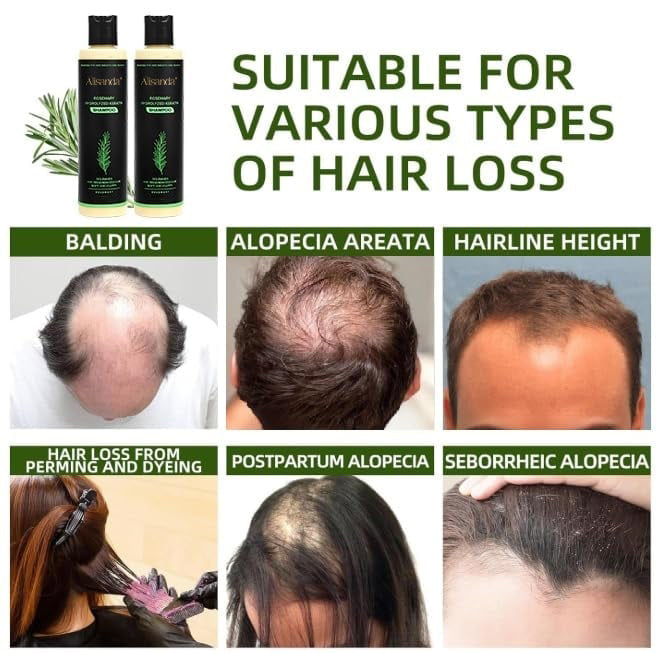 🔥LAST DAY 50% OFF - 🎅Alisanda® Organic Rosemary Hair Growth Shampoo