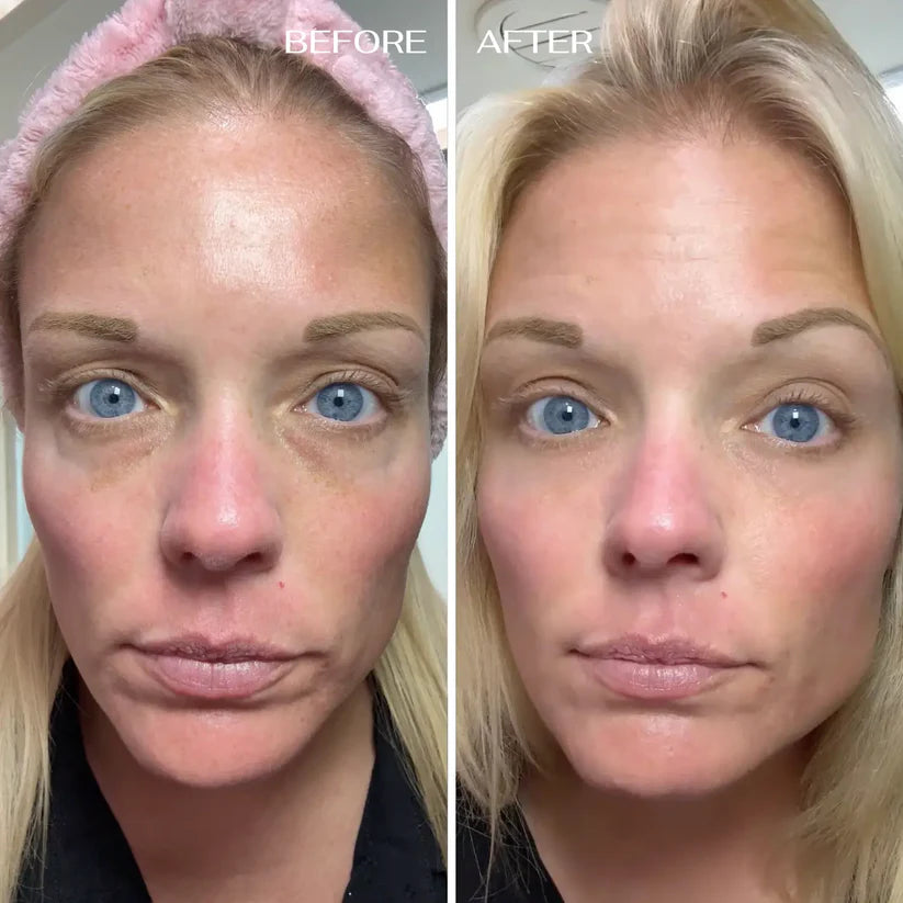 ALL-IN-ONE BALM FOR UNDER-EYE RENEWAL