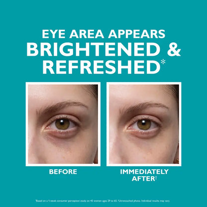 🏆Flash Sale ✨ PEPTIDE SKINJECTION FILL+ FIX UNDER-EYE CREAM ✨The secret to making your eyes look 5 years younger!👁️