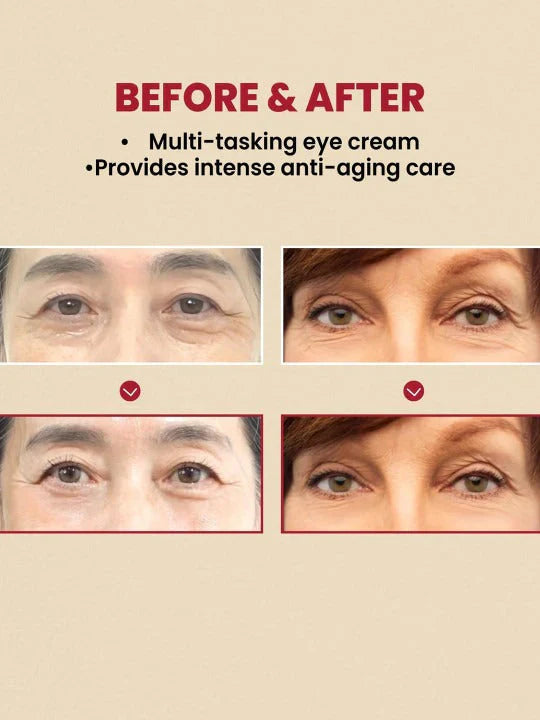 🌟 K Secret Seoul 1988 Eye Cream – Timeless Korean Radiance for Your Eyes 🌟