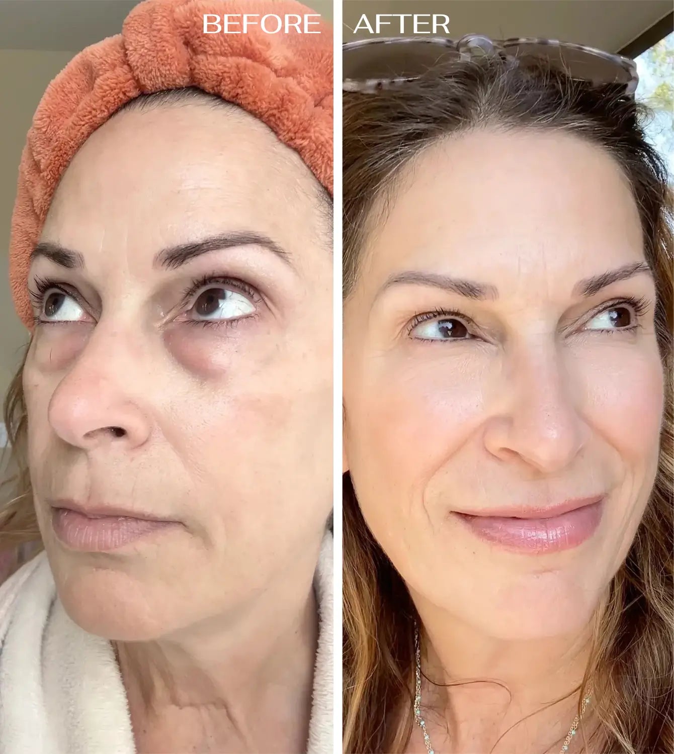 ALL-IN-ONE BALM FOR UNDER-EYE RENEWAL