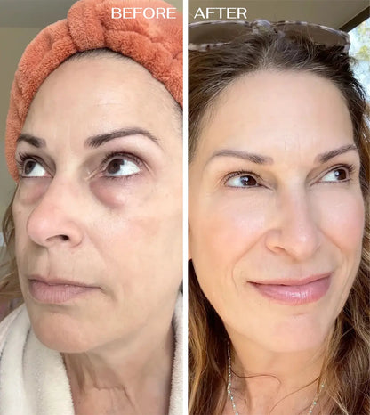 ALL-IN-ONE BALM FOR UNDER-EYE RENEWAL